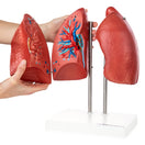 Switch he right hand side model presents a cross section of the human lung 3 image