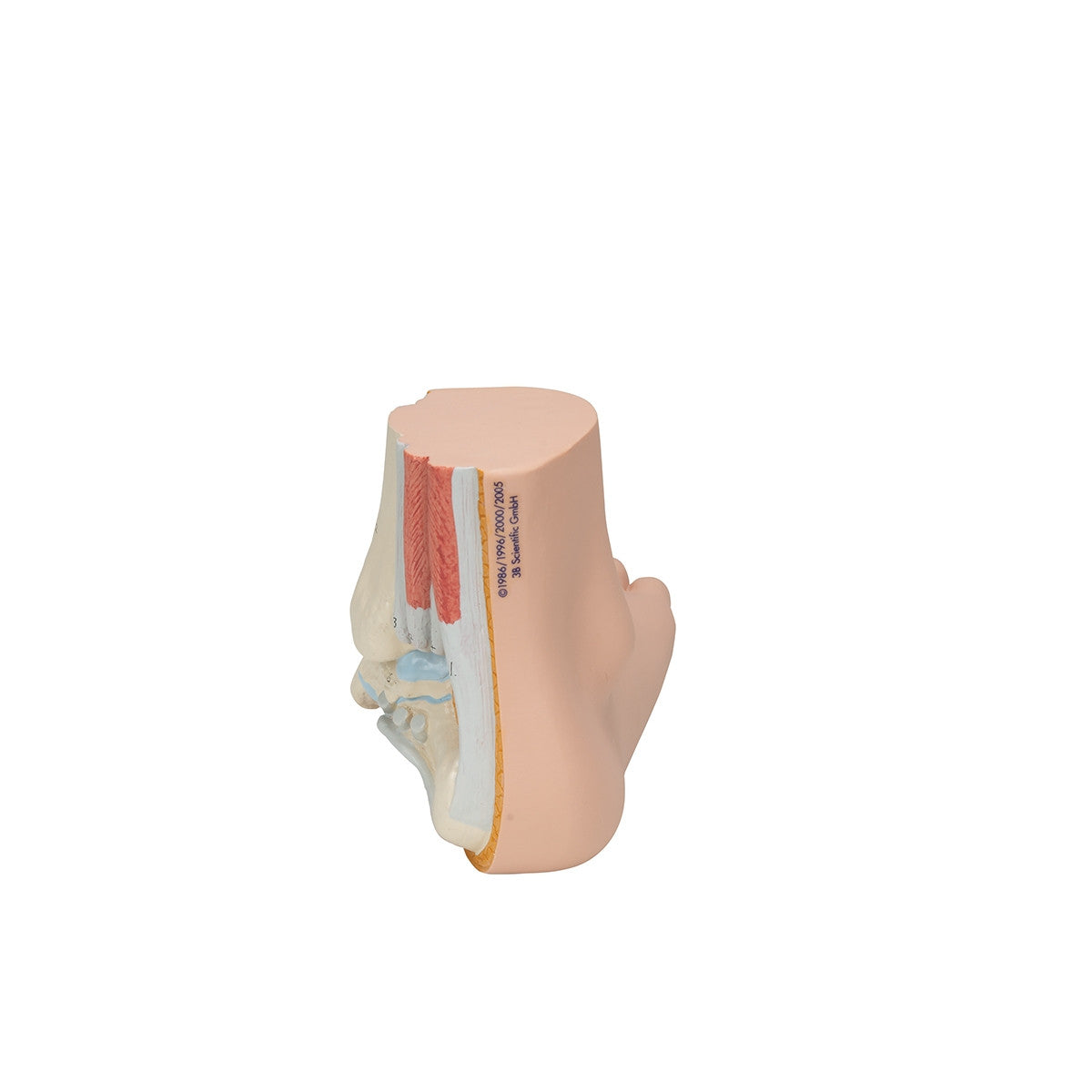 Flat Foot Model (Pes Planus)