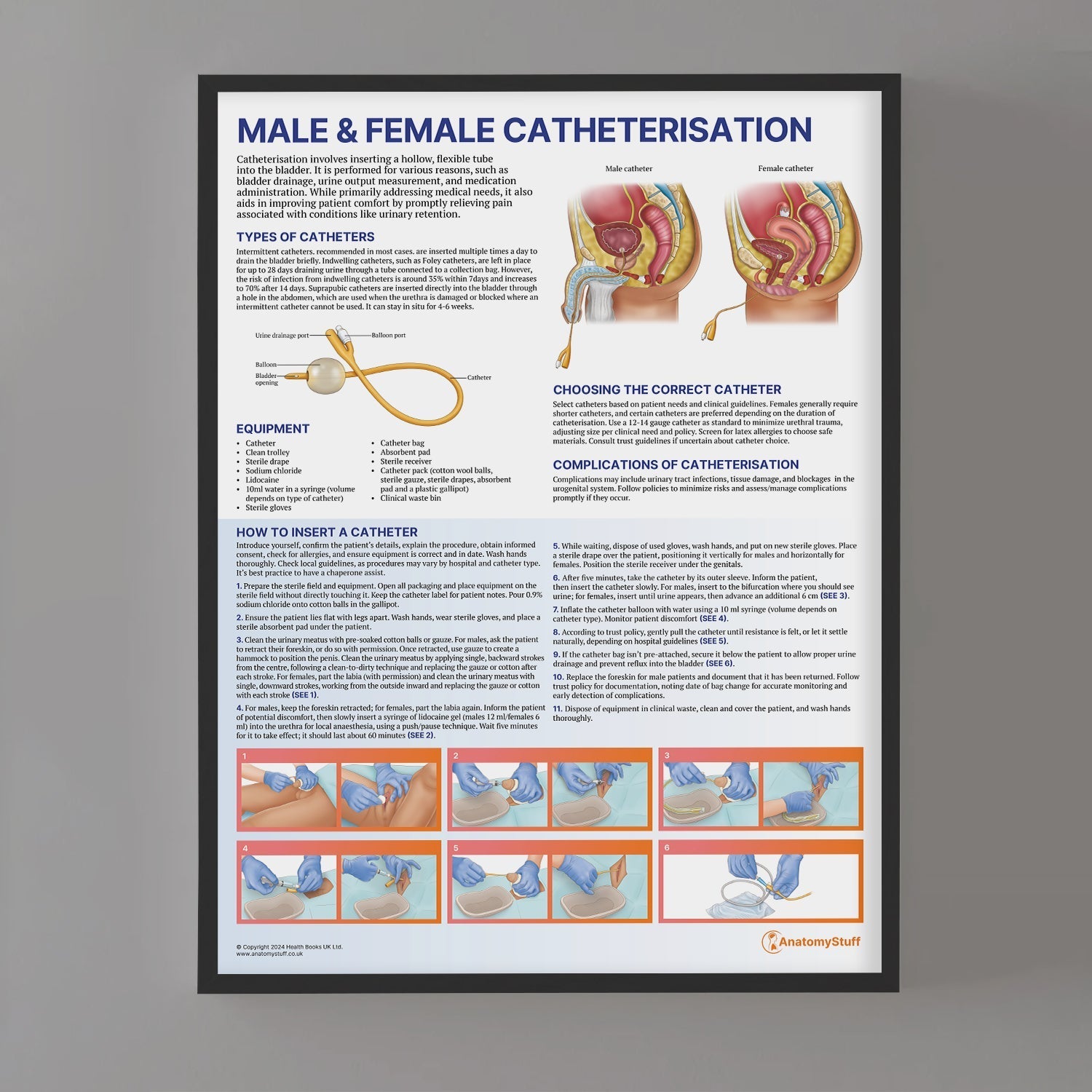 Male and Female Catheterisation Chart / Poster - Part of Collection