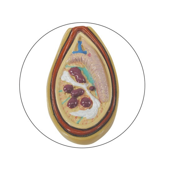 Male Pelvis Section Model with Testicular Cancer