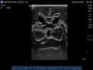 Switch Newborn Head (Complex) for X-Ray CT, US, MRI HD-N01 image 3 3 image