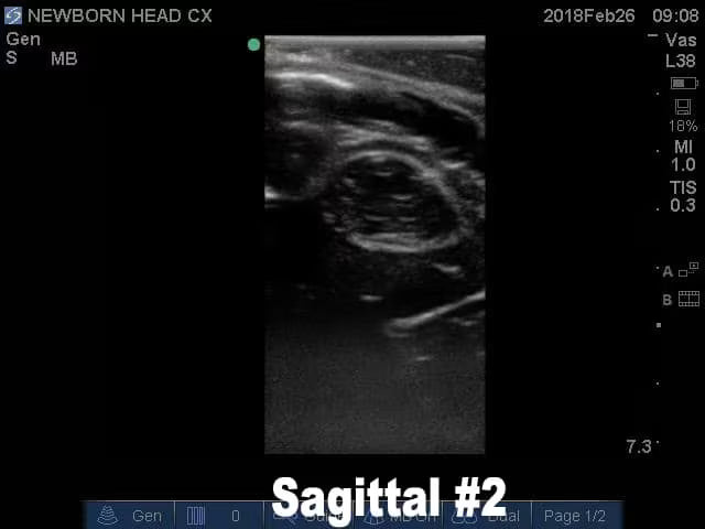 Newborn Head Phantom (Complex) for X-Ray CT, US, MRI