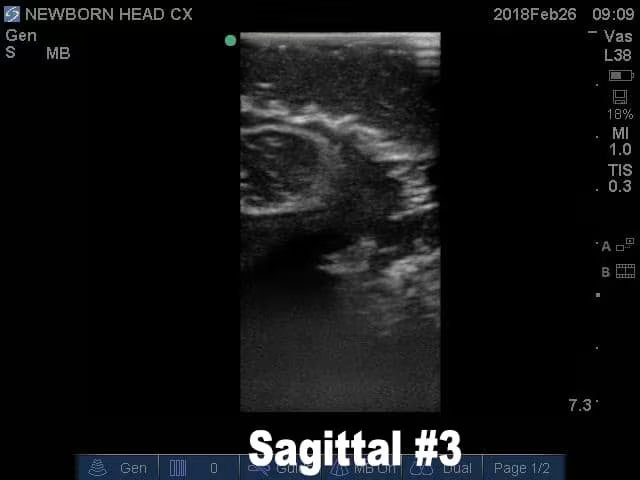 Newborn Head Phantom (Complex) for X-Ray CT, US, MRI
