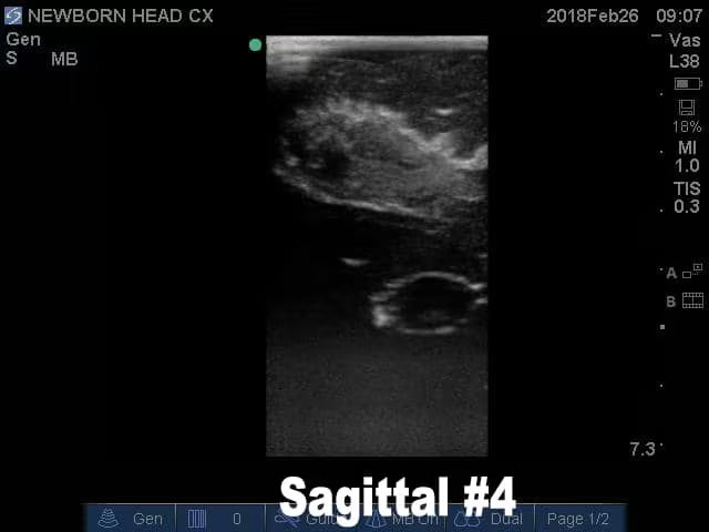 Newborn Head Phantom (Complex) for X-Ray CT, US, MRI