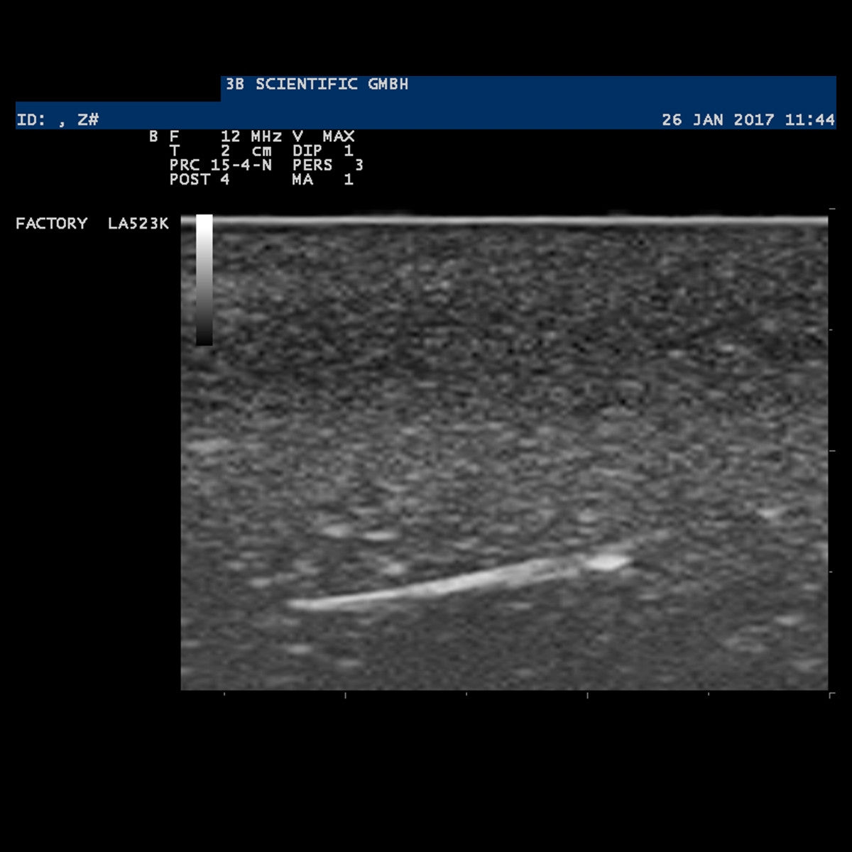 SONOtrain Ultrasound Foreign Body Model
