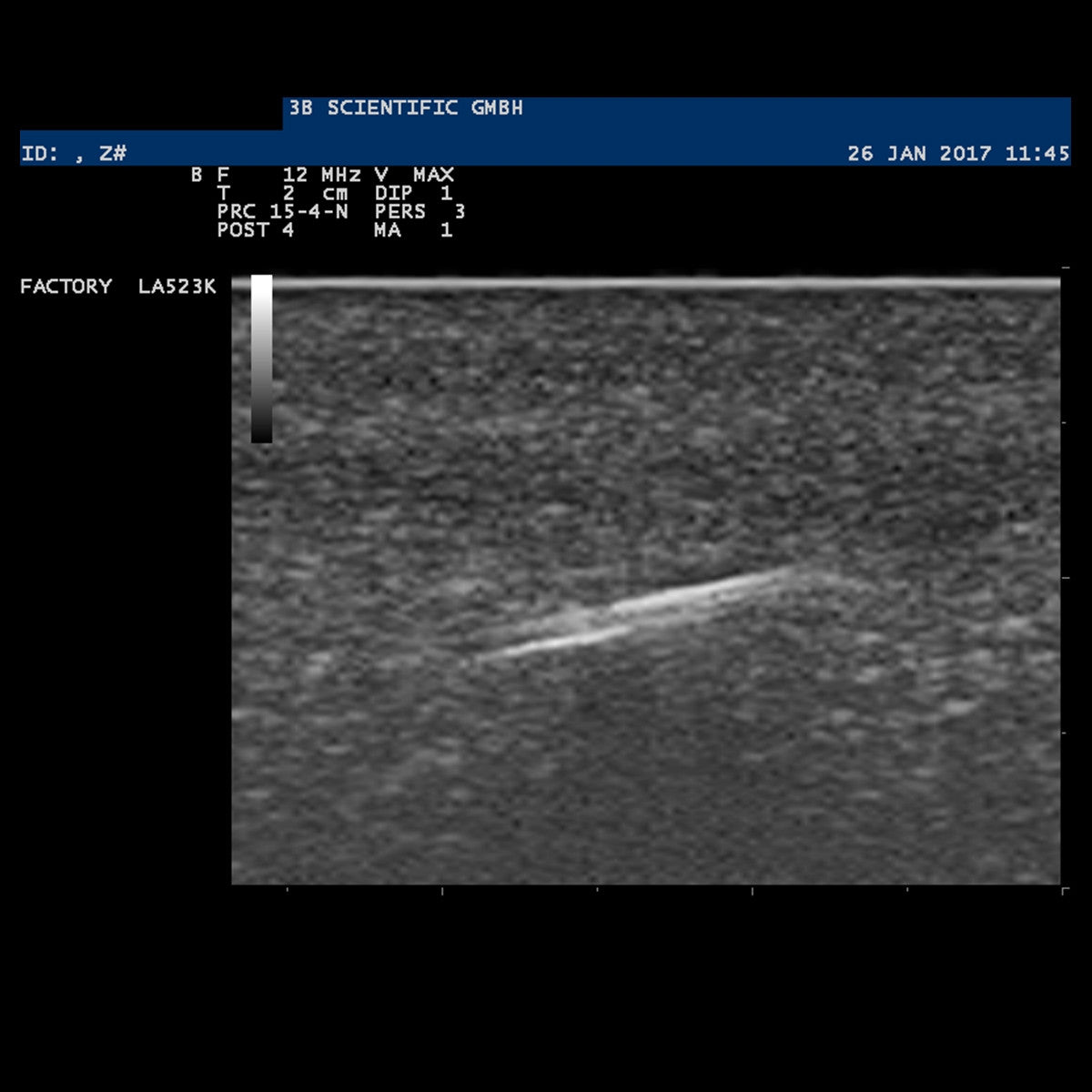 SONOtrain Ultrasound Foreign Body Model
