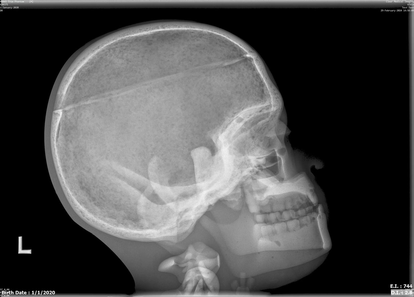Paediatric Full Body for X-Ray CT, MRI FB-P01 image 12