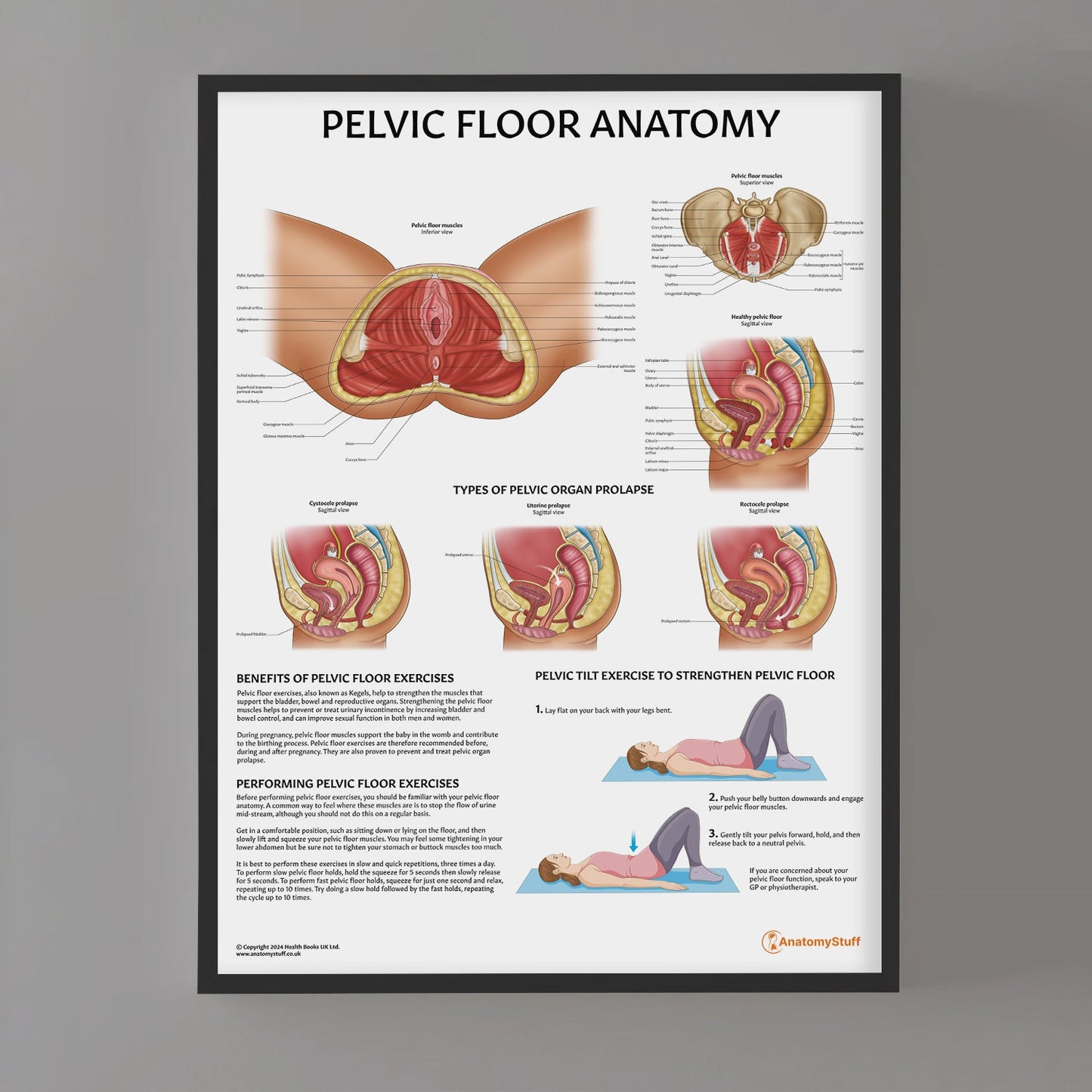 Pelvic Floor Anatomy Chart / Poster - Part of Collection