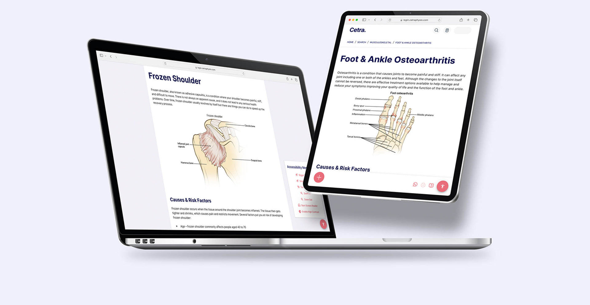 Search and share hundreds of medically written and reviewed patient education handouts on common MSK and health conditions.