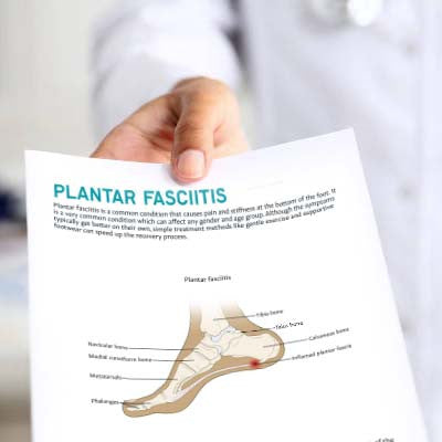 Plantar Fasciitis Printable Resource