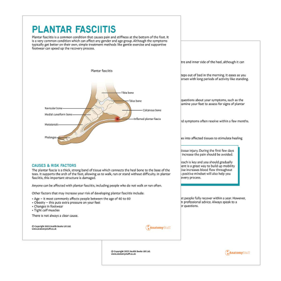 Plantar Fasciitis Patient Education Handout (Printable PDF)