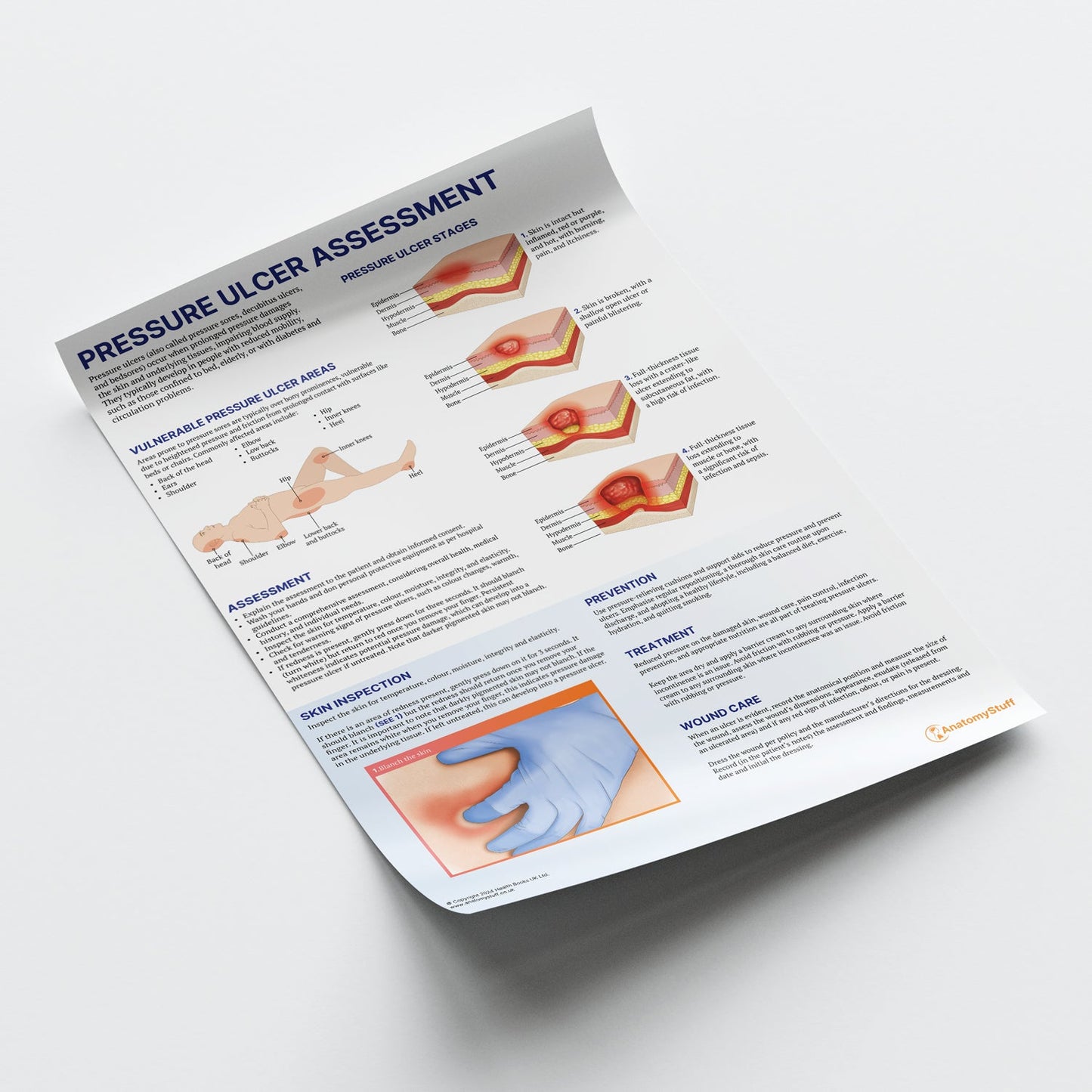 Pressure Ulcer Assessment and Care Chart / Poster - Part of Collection