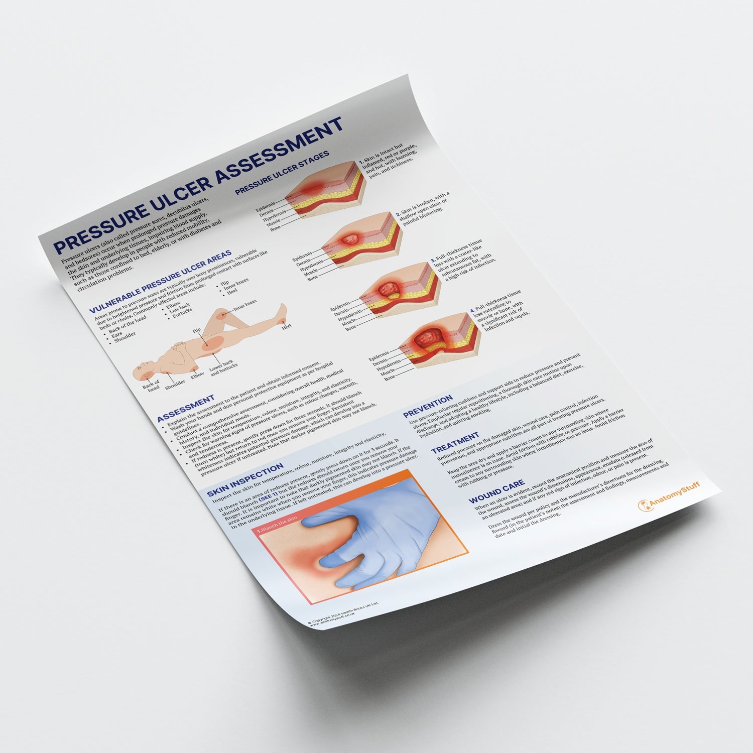 Pressure Ulcer Assessment and Care Chart / Poster - Part of Collection