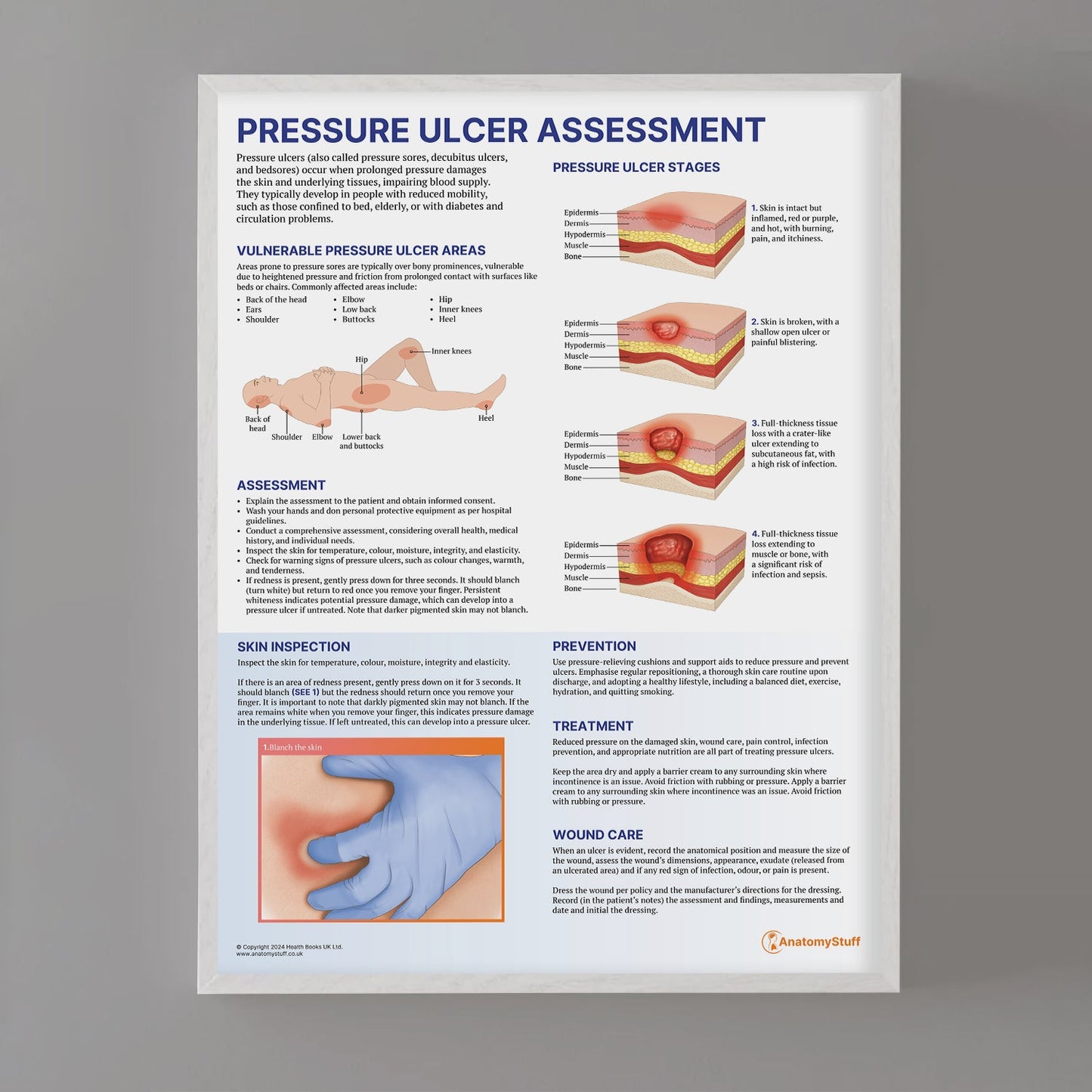 Pressure Ulcer Assessment and Care Chart / Poster - Part of Collection