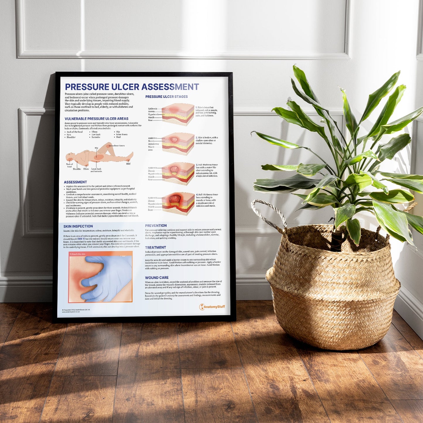 Pressure Ulcer Assessment and Care Chart / Poster - Part of Collection