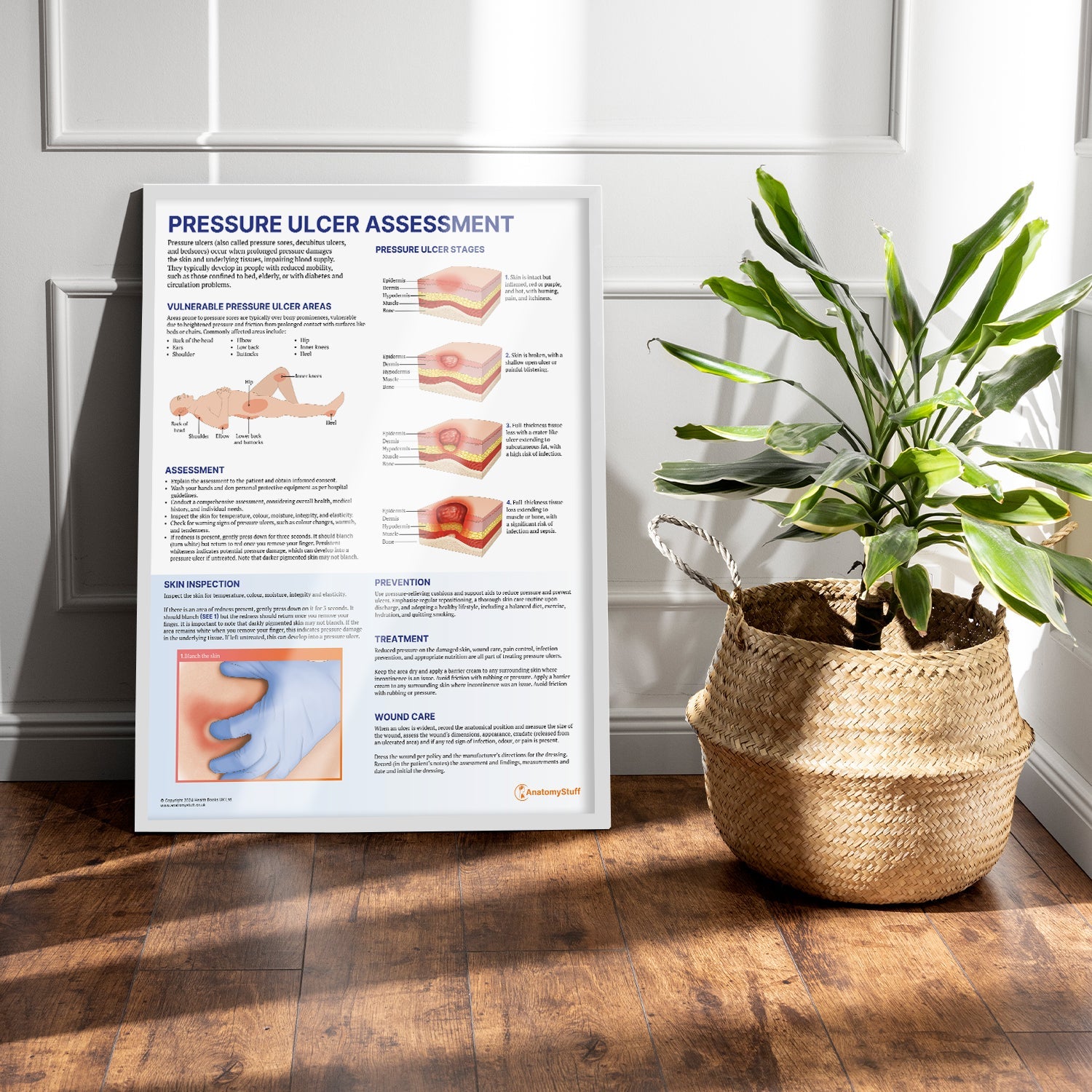 Pressure Ulcer Assessment and Care Chart / Poster - Part of Collection