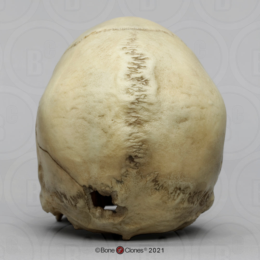 Bone Clones Forensic Trauma Skulls