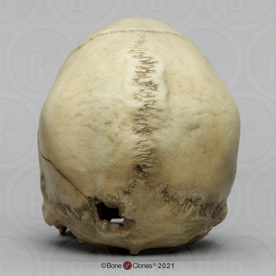 Bone Clones Forensic Trauma Skulls