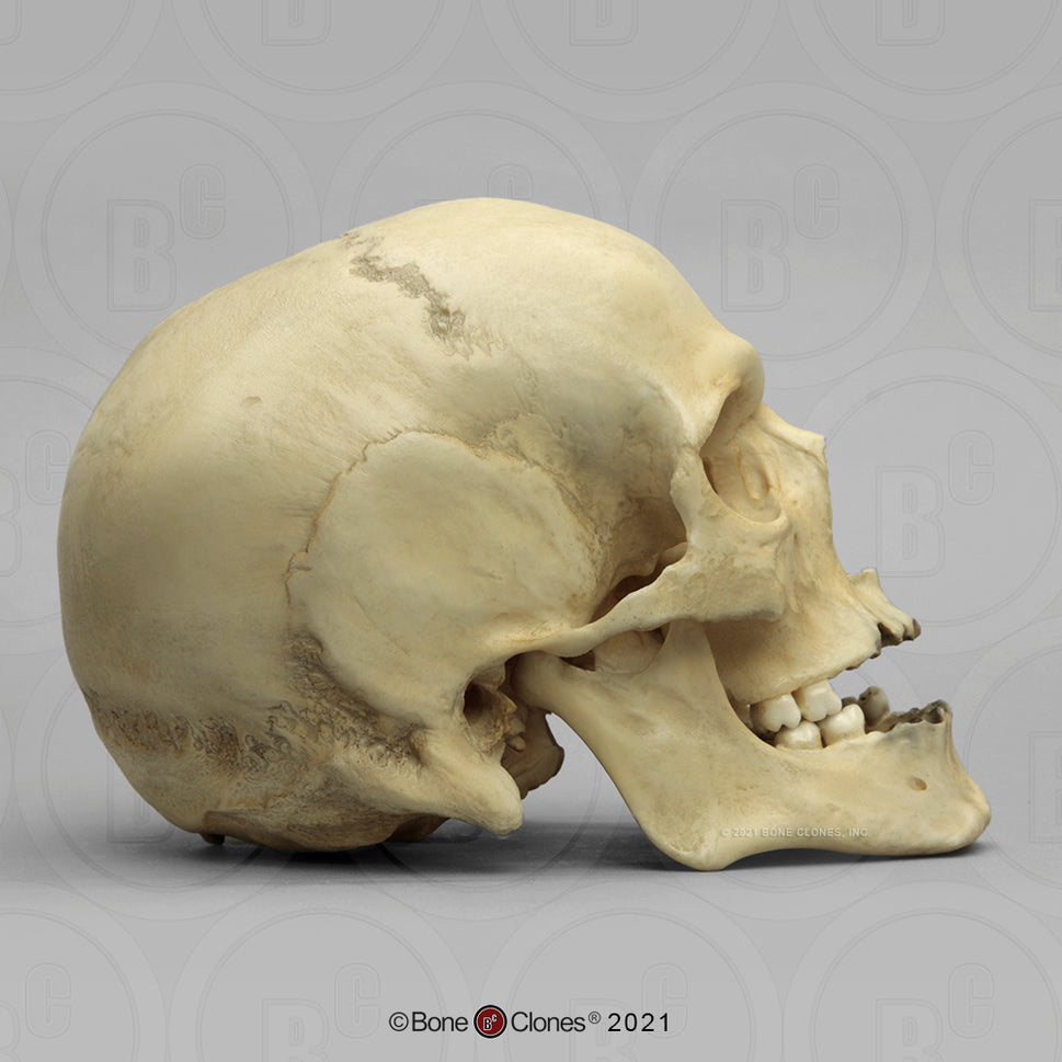 Bone Clones Forensic Trauma Skulls