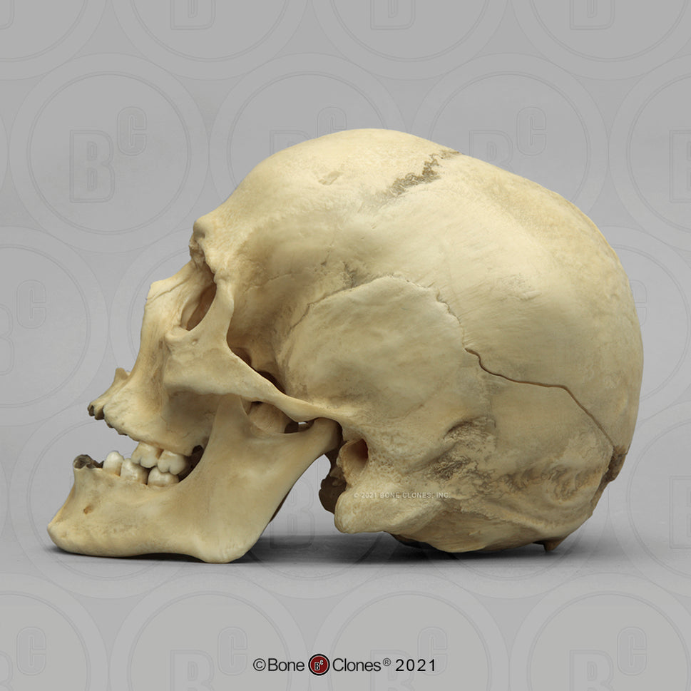 Bone Clones Forensic Trauma Skulls