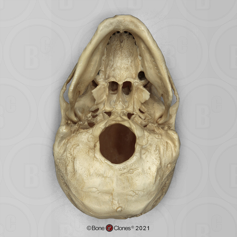 Bone Clones Forensic Trauma Skulls