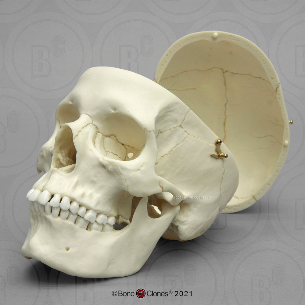 Female European Skull with Calvarium Cut BC-150 front view
