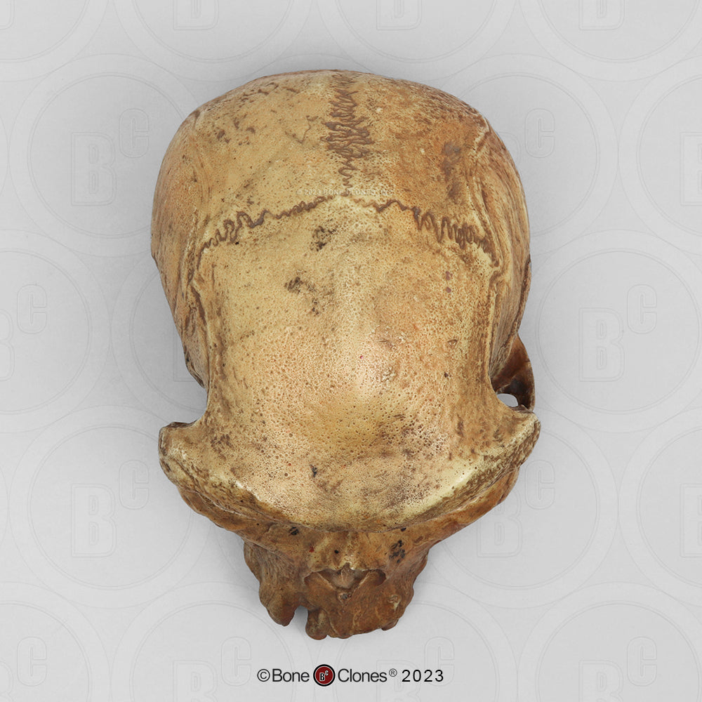 Homo heidelbergensis Broken Hill 1 Cranium (Rhodesian Man) BH-004 top view