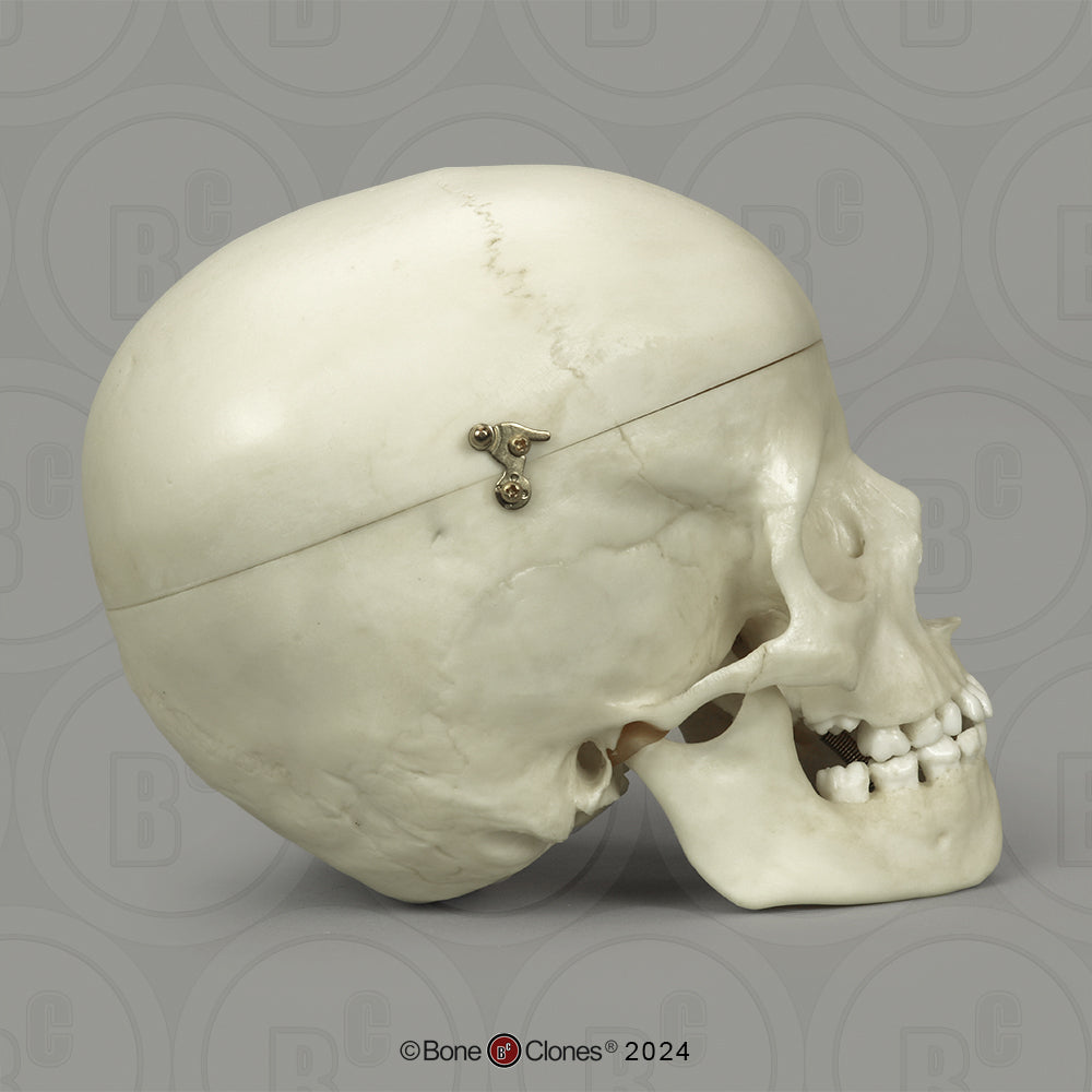 BC-01-C Child Skull Model (6 Year Old)
calvarium cut