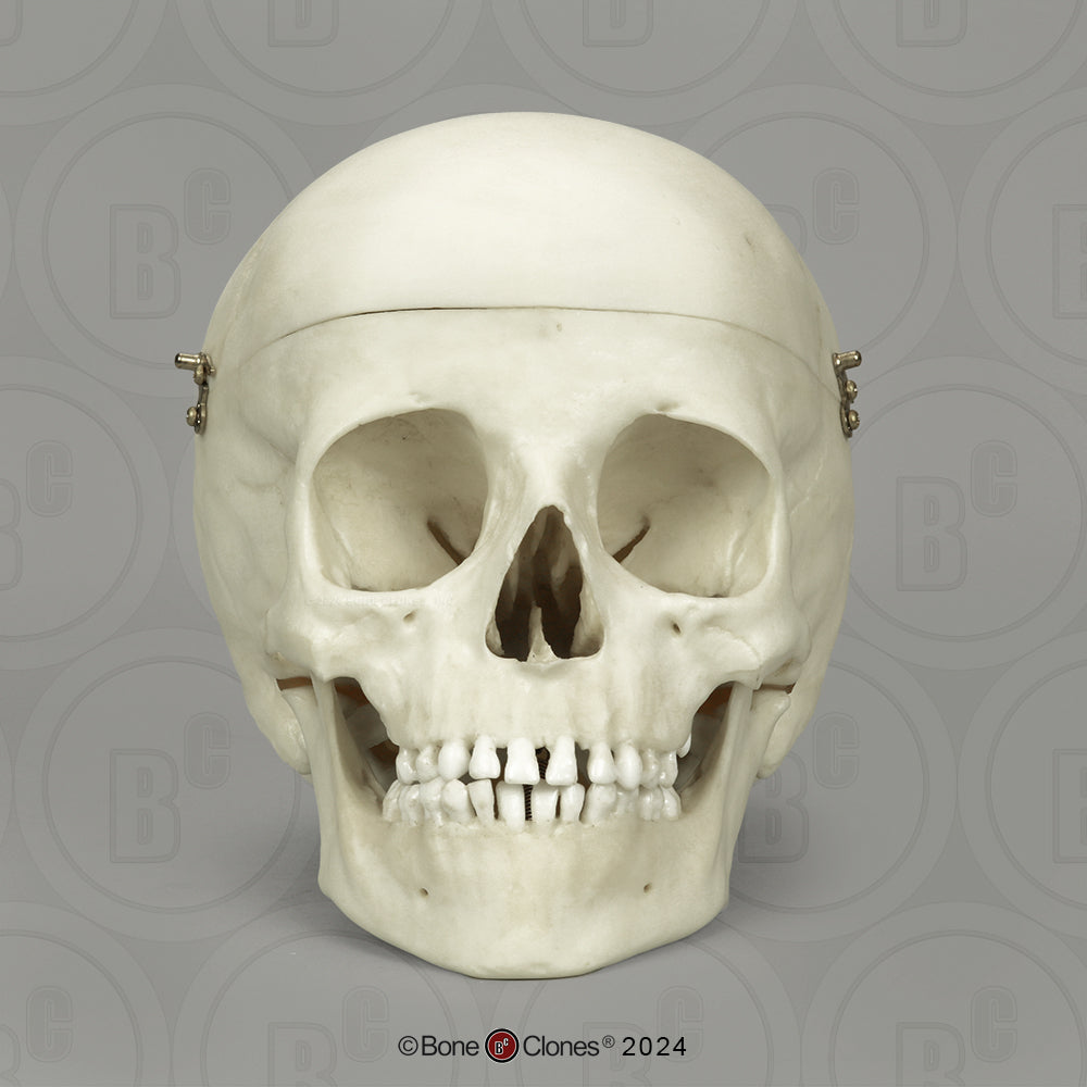 BC-01-C Child Skull Model (6 Year Old)
calvarium cut