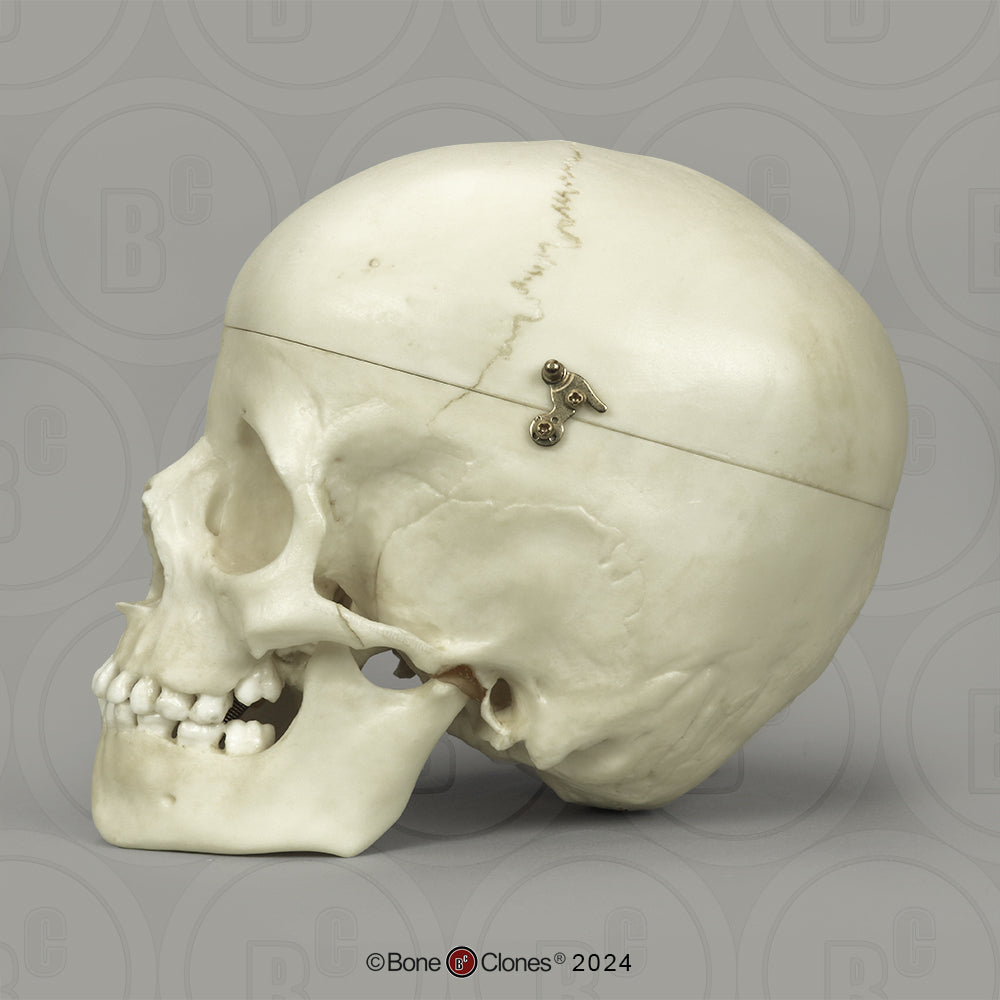 BC-01-C Child Skull Model (6 Year Old)
calvarium cut