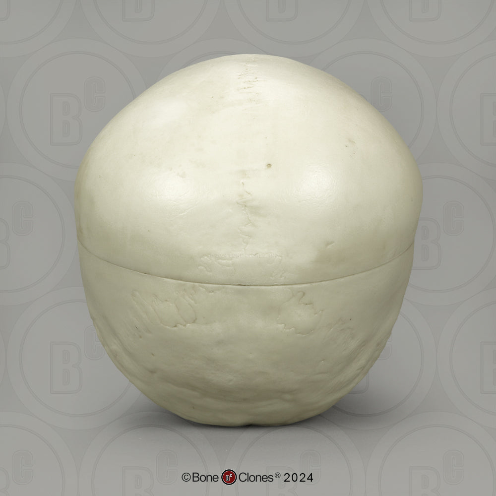 BC-01-C Child Skull Model (6 Year Old)
calvarium cut