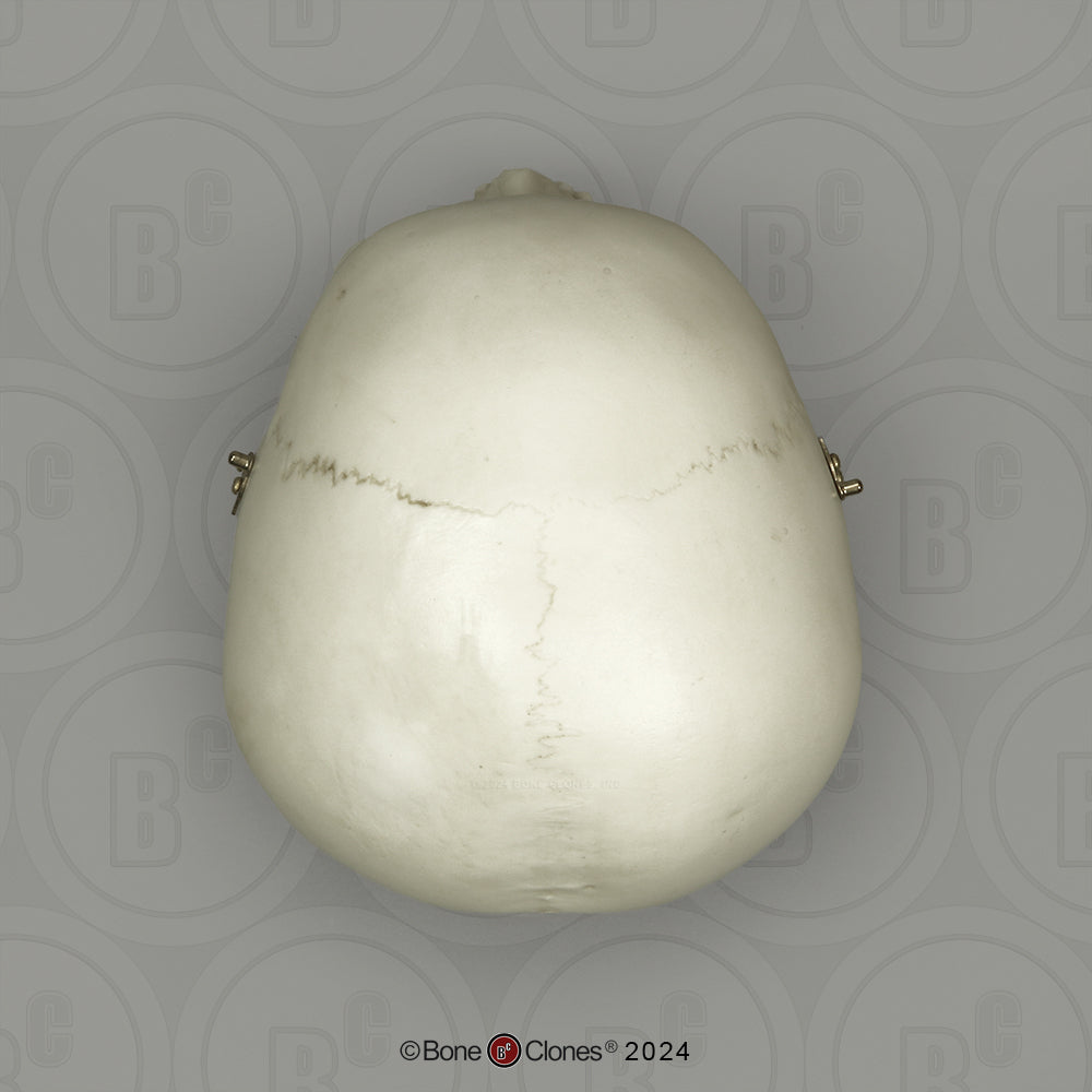 BC-01-C Child Skull Model (6 Year Old)
calvarium cut