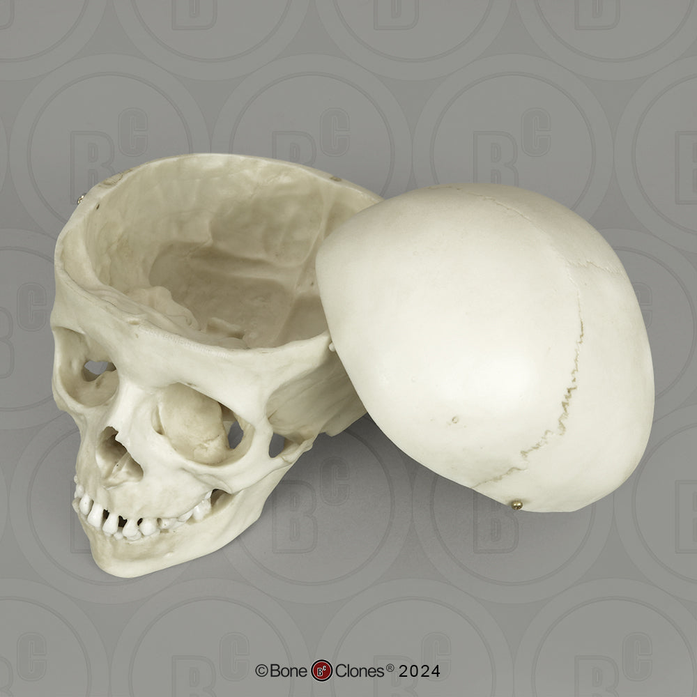 BC-01-C Child Skull Model (6 Year Old)
calvarium cut