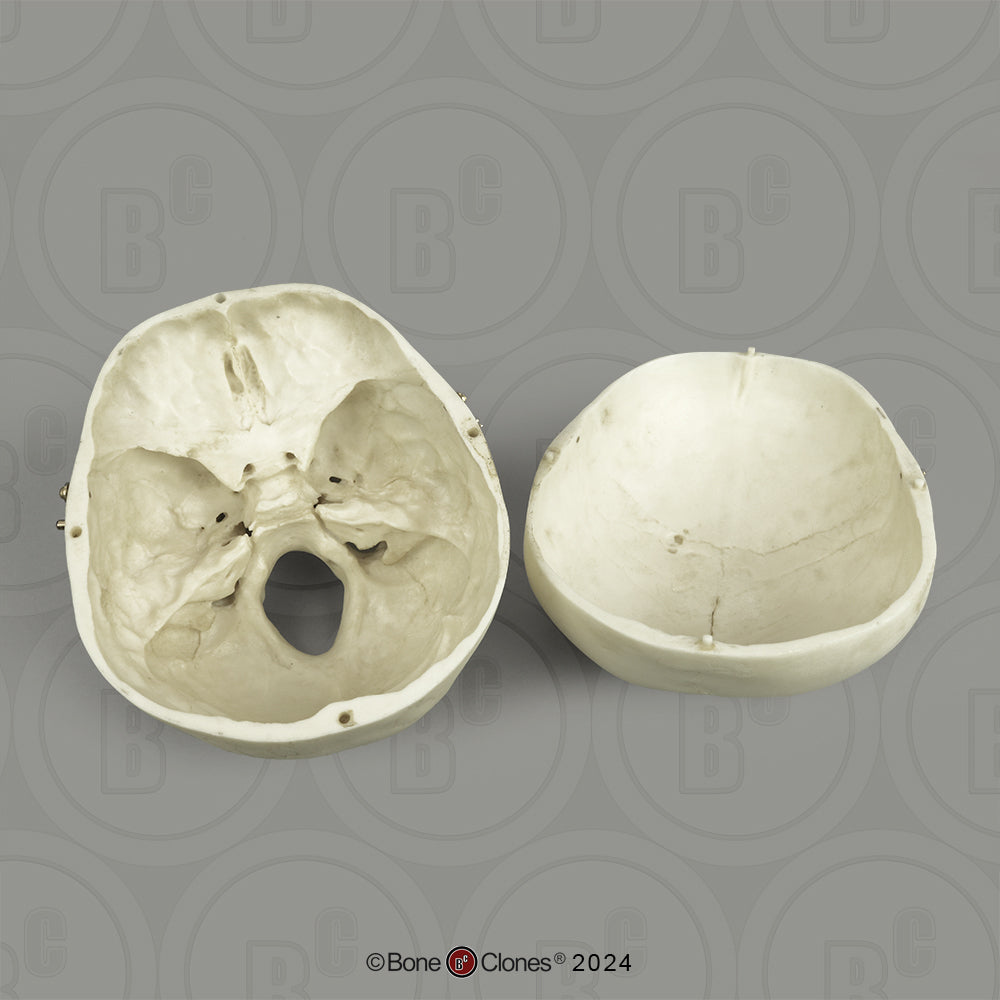 BC-01-C Child Skull Model (6 Year Old)
calvarium cut
