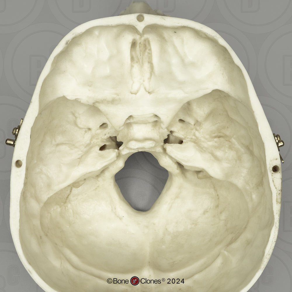 BC-01-C Child Skull Model (6 Year Old)
calvarium cut