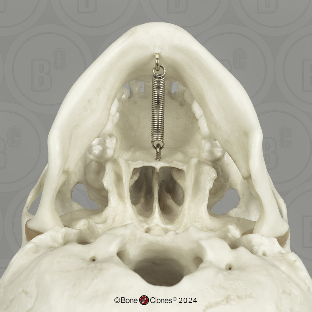 BC-01-C Child Skull Model (6 Year Old)
calvarium cut