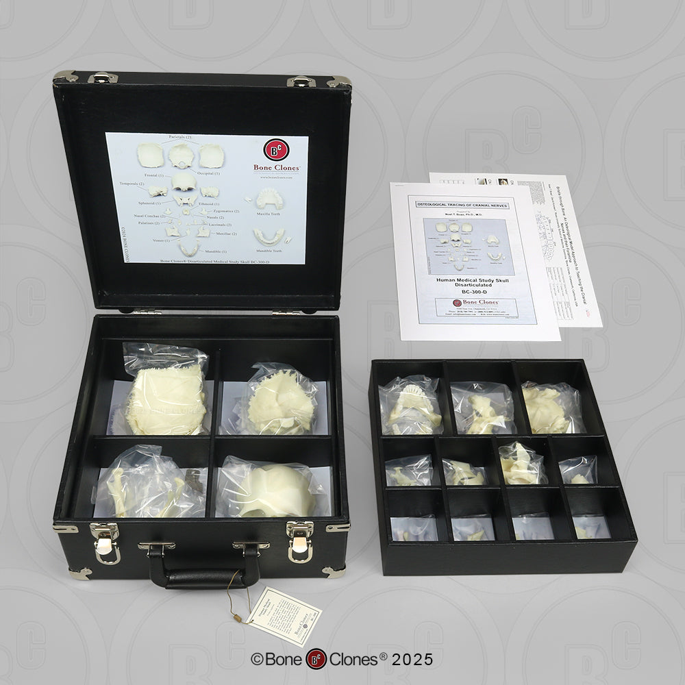 BC-300-D in custom case