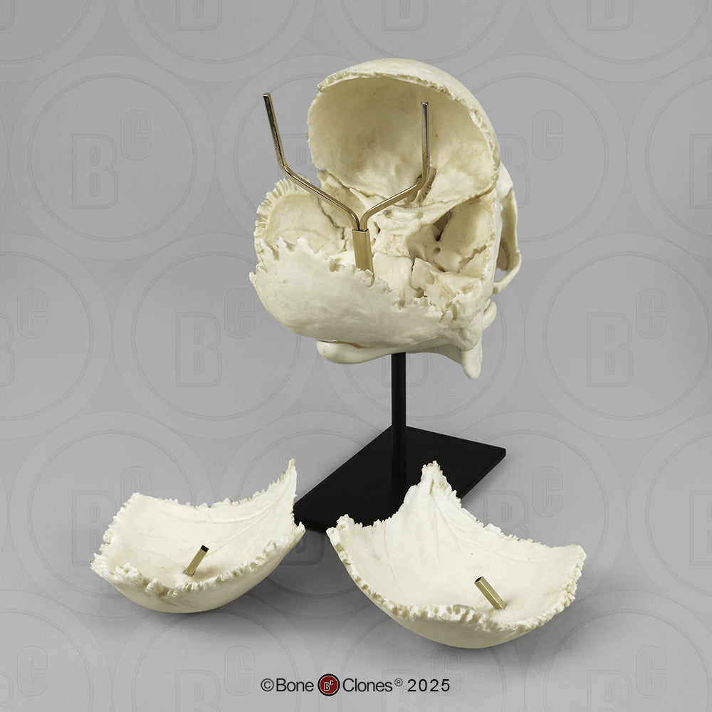 BC-300-A rear parts removed