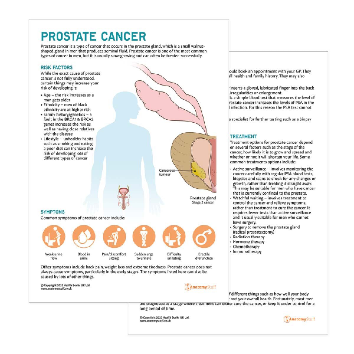 Prostate Cancer Patient Education Handout (Printable PDF)