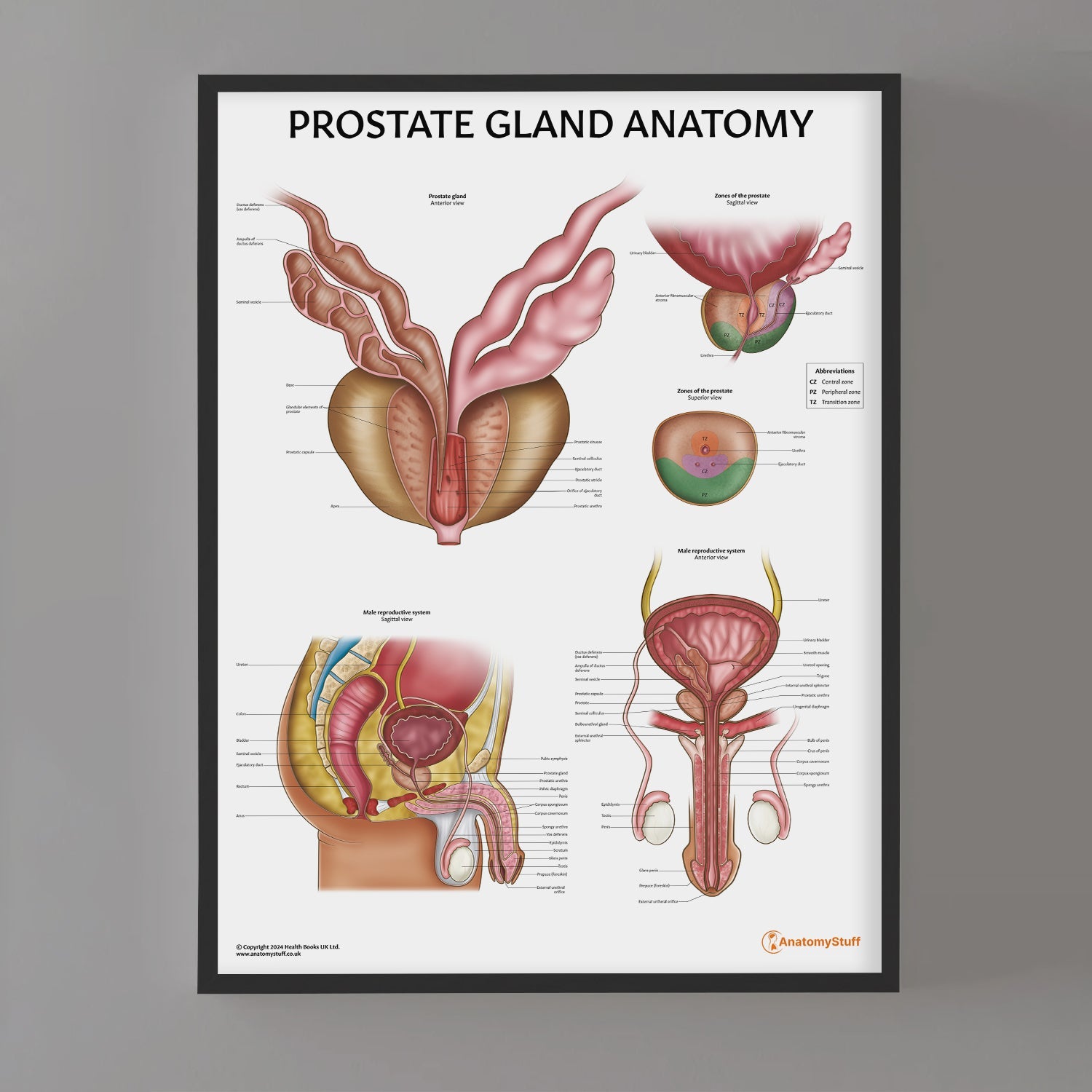 Prostate Anatomy Chart / Poster - Part of Collection