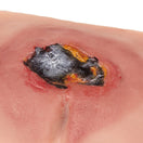 Switch The Wound Moulage Sacral Decubitus is ideal for training of why pressure sores and ulcers must be avoided for workers 3 image