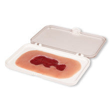 Small Wound Moulage Venous Leg Ulcer in Granulation Phase - PW002B