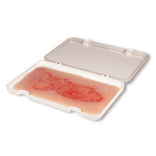Large Wound Moulage Venous Leg Ulcer in Epithelisation Phase PW003C