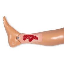Wound Moulage