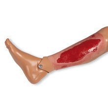 Wound Moulage