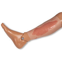 Wound Moulage
