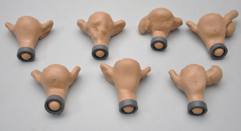 Uteri with External Abnormalities