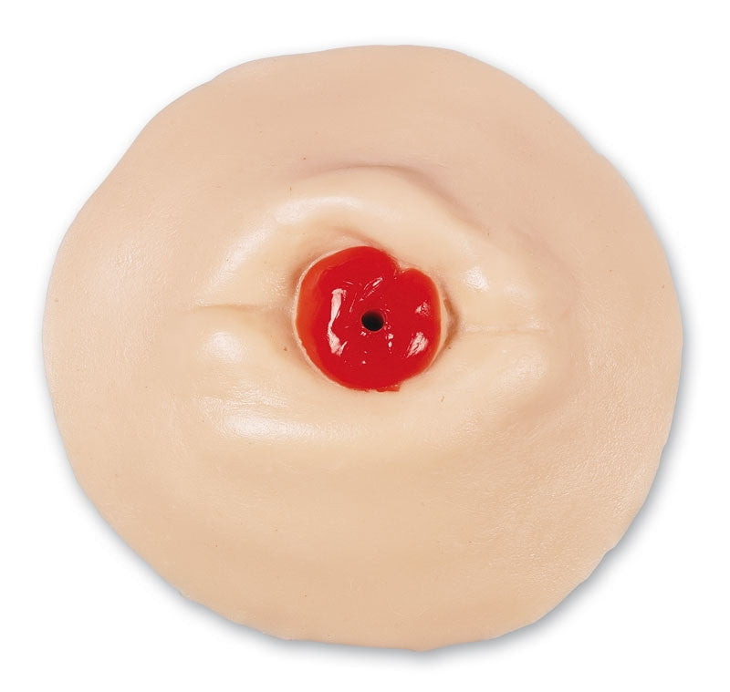 Retracted Ostomy Care Training Model