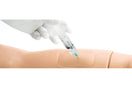 Switch Subcutaneous Injection Site on Volar Part of Arm 2 image