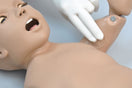 Switch Palpable Brachial Pulse 2 image